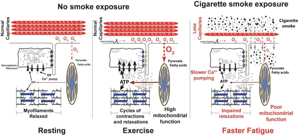 cause of cigarette Tobacco health risks: MedlinePlus Medical Encyclopedia Image