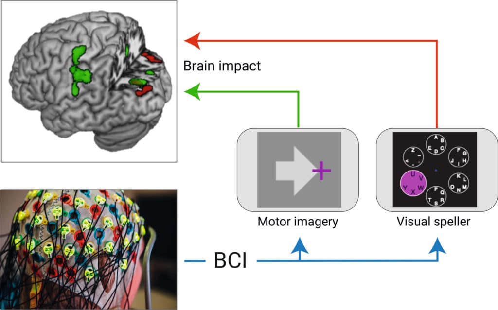 Personalising stroke treatment using brain computer interfaces - The ...